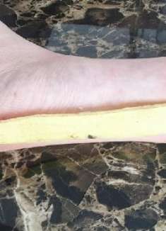 吃剩的香蕉皮绑在脚底作用厉害了，很少有人知道